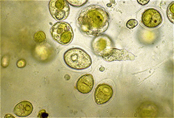 Well Testing Bacteria Connecticut E. coli  coiform CT